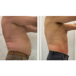 ШОК! Похудение на 7 кг. за 30 дней