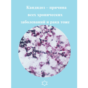 Кандидоз – причина всех хронических заболеваний и рака