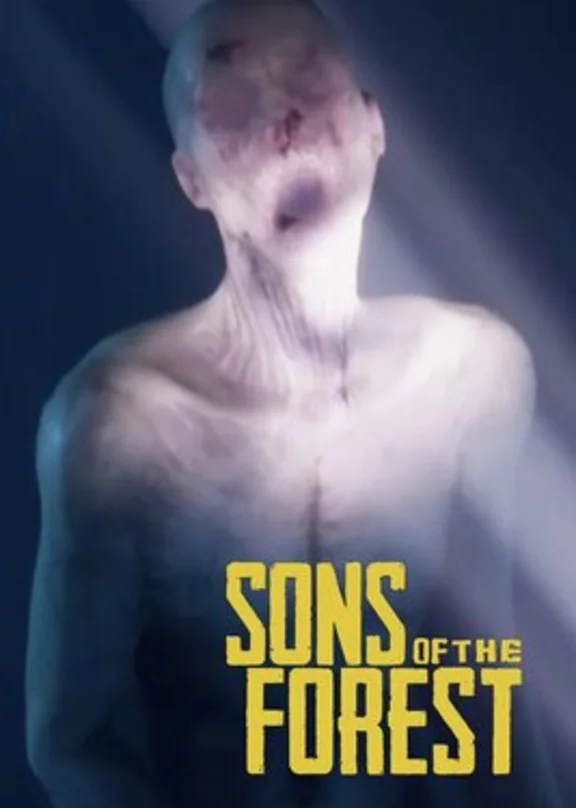 ✅ Sons of the Forest