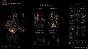 Darkest Dungeon II STEAM KEY РФ+СНГ СТИМ ЛИЦЕНЗИЯ