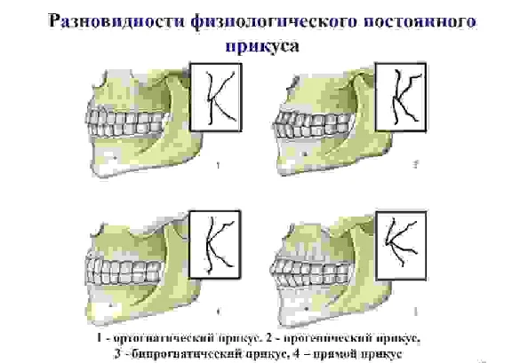 Bite options in humans