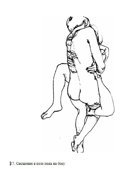 Kaplan HS Sexual therapy. Illustrated Guide