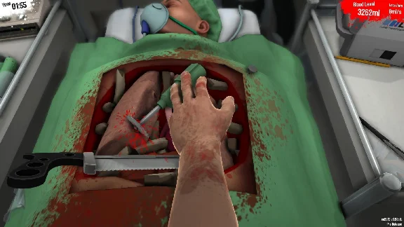 Surgeon Simulator 💎 АВТОДОСТАВКА STEAM РОССИЯ