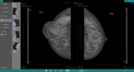 DICOM Viewer Essential Подписка 1, 3, 6, 12 месяцев ✅ Microsoft Store ПК