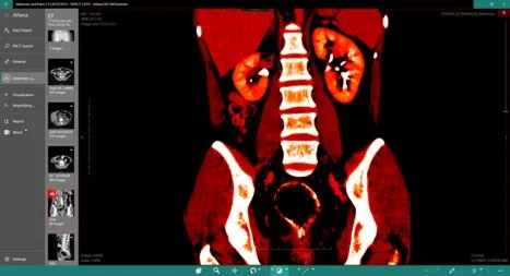 DICOM Viewer Essential Подписка 1, 3, 6, 12 месяцев ✅ Microsoft Store ПК
