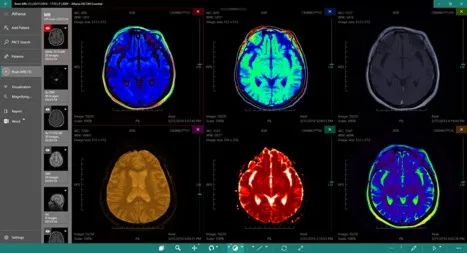 DICOM Viewer Essential Подписка 1, 3, 6, 12 месяцев ✅ Microsoft Store ПК