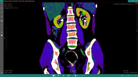 DICOM Viewer Essential Подписка 1, 3, 6, 12 месяцев ✅ Microsoft Store ПК