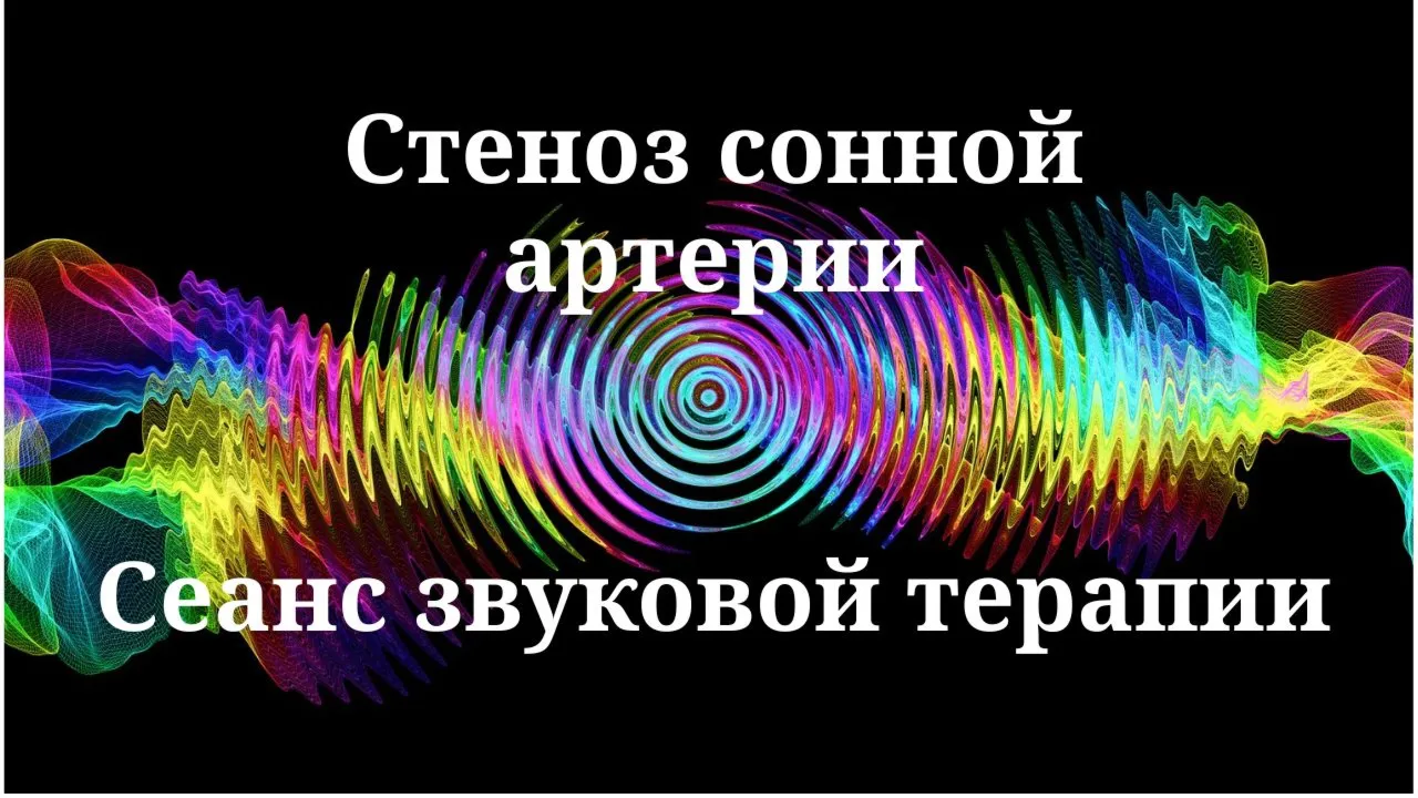 Стеноз сонной артерии — сеанс звуковой терапии