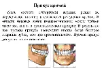 Варианты прикусов у человека