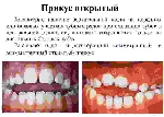 Варианты прикусов у человека