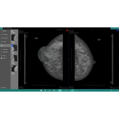 DICOM Viewer Essential Подписка 1, 3, 6, 12 месяцев Microsoft Store ПК - irongamers.ru