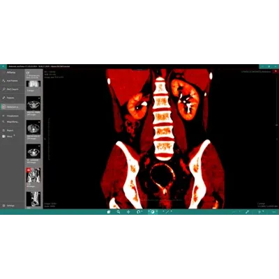DICOM Viewer Essential Подписка 1, 3, 6, 12 месяцев Microsoft Store ПК - irongamers.ru