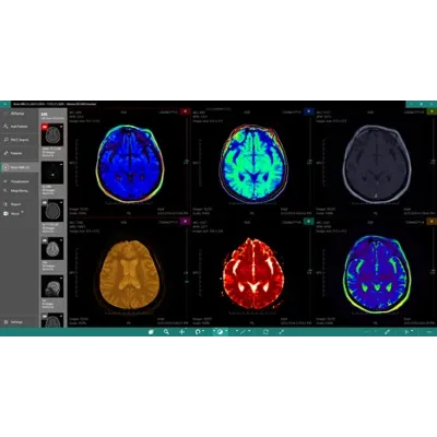 DICOM Viewer Essential Подписка 1, 3, 6, 12 месяцев Microsoft Store ПК - irongamers.ru