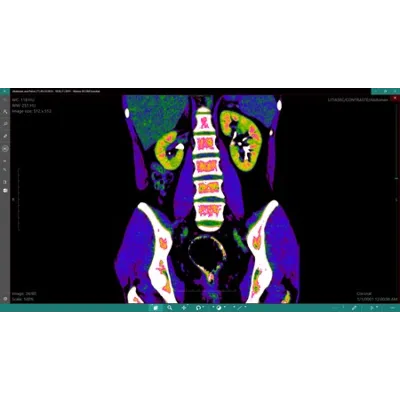 DICOM Viewer Essential Подписка 1, 3, 6, 12 месяцев Microsoft Store ПК - irongamers.ru