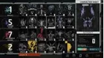 🧡 Disco Elysium - The Final Cut XBOX ONE / SERIES KEY🔑 