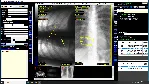 DICOM Рабочая станция врача-рентгенолога и лаборанта