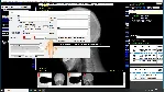 DICOM Рабочая станция врача-рентгенолога и лаборанта