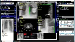 DICOM Рабочая станция врача-рентгенолога и лаборанта