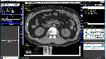 DICOM Рабочая станция врача-рентгенолога и лаборанта