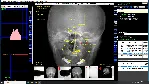 DICOM Рабочая станция врача-рентгенолога и лаборанта