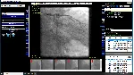 DICOM Рабочая станция врача-рентгенолога и лаборанта