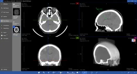 DICOM Viewer Expert Подписка 1, 3, 6, 12 месяцев ✅ Microsoft Store ПК