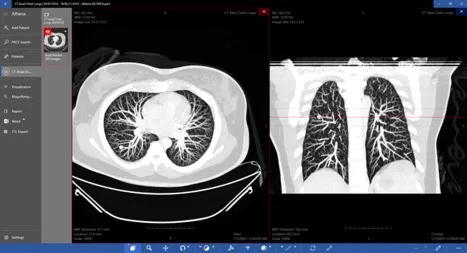 DICOM Viewer Expert Подписка 1, 3, 6, 12 месяцев ✅ Microsoft Store ПК