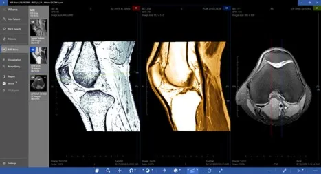 DICOM Viewer Expert Подписка 1, 3, 6, 12 месяцев ✅ Microsoft Store ПК