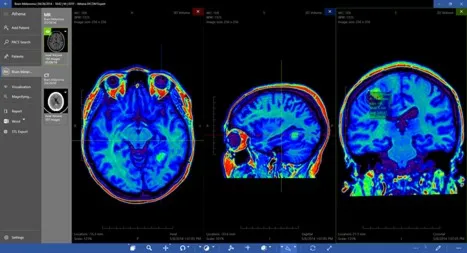 DICOM Viewer Expert Подписка 1, 3, 6, 12 месяцев ✅ Microsoft Store ПК