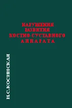 Нарушения развития костно-суставного аппарата