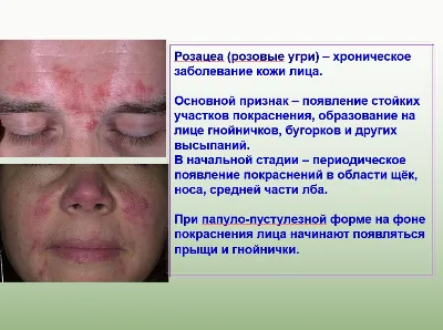 Я решаю свои проблемы спокойно (Галина)