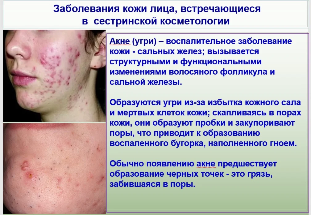 диплом профилактика в косметологическом кабинете