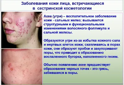 Я решаю свои проблемы спокойно (Геннадий)