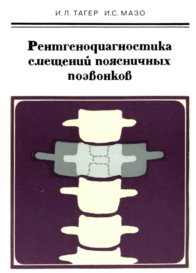 Рентгенодиагностика смещений поясничных позвонков 1979
