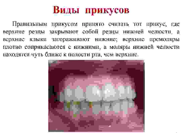 Bite options in humans