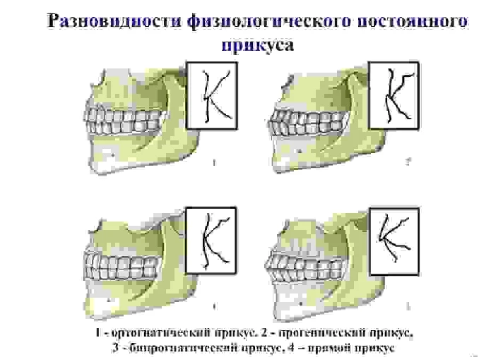 Bite options in humans