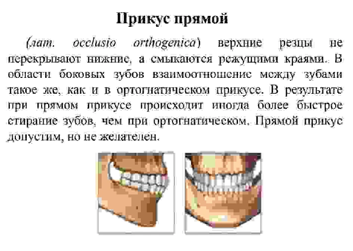 Bite options in humans