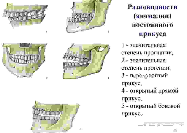 Bite options in humans