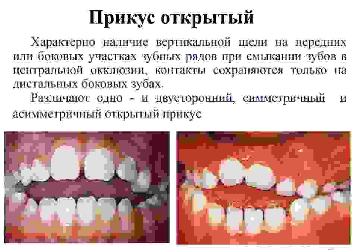 Bite options in humans