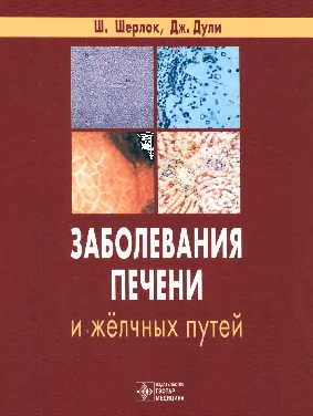 Заболевания печени и желчных путей   Шерлок Ш.